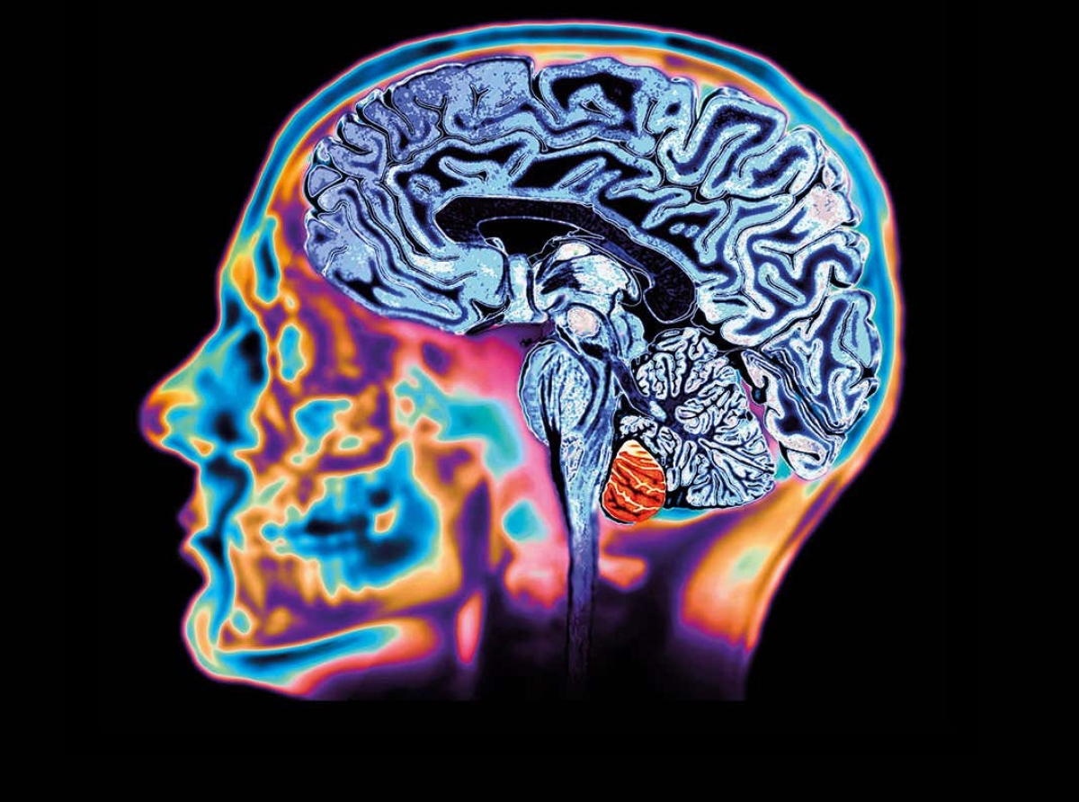 El cerebro durante la muerte