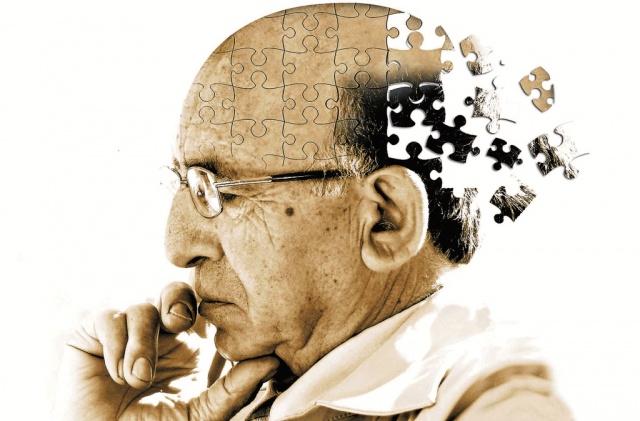 El Alzheimer afecta a más de 50 millones de personas en el mundo