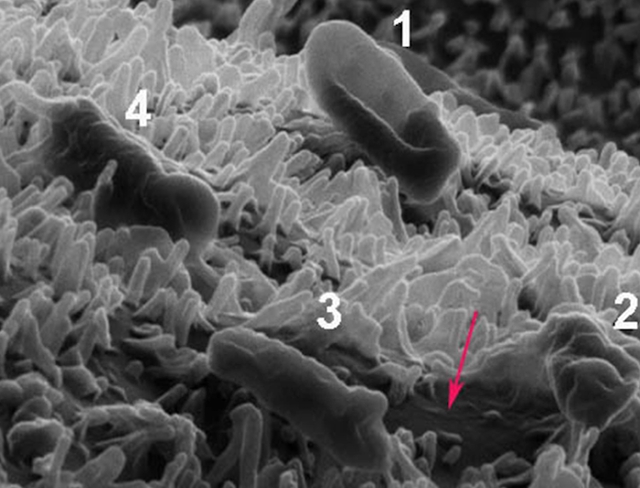 Superficie nano-texturada del ala de una libélula. Nanopilares largos y cortos, contenido celular, bacterias muertas